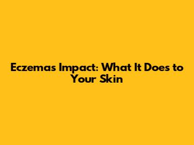 Eczema's Impact: What It Does to Your Skin